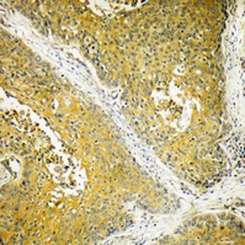 Dynein LC 2 rabbit pAb