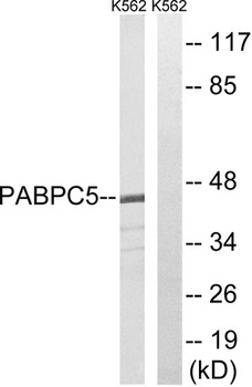 PABP5 rabbit pAb