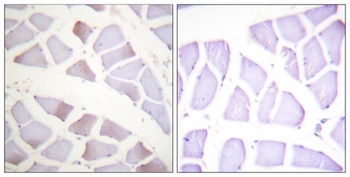 Crystallin-αB (phospho Ser19) rabbit pAb
