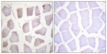 Crystallin-αB (phospho Ser59) rabbit pAb