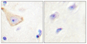 IL-3Rβ (phospho Tyr593) rabbit pAb