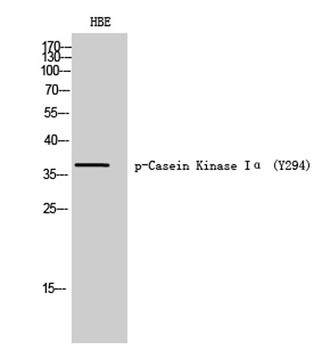 Casein Kinase Ialpha (phospho-Tyr294) antibody