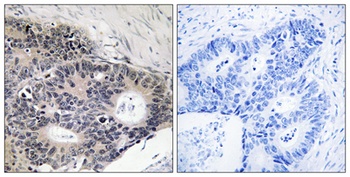 ABHD12B antibody