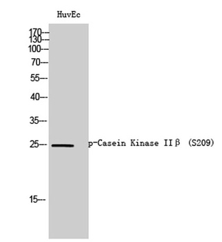 Casein Kinase II beta (phospho-Ser209) antibody