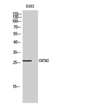 CMTM2 antibody