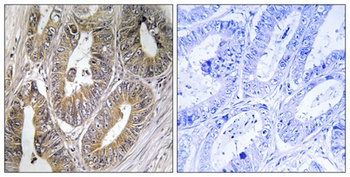 Cystatin SA antibody