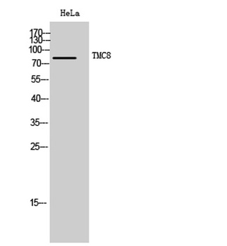 TMC8 rabbit pAb
