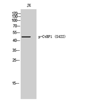 CtBP1 (phospho Ser422) rabbit pAb