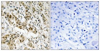 CtBP1 rabbit pAb Antibody