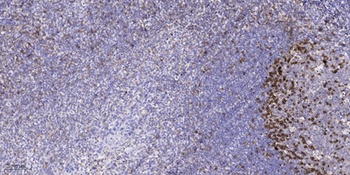 Catenin-alpha 1 (phospho-Ser641) antibody