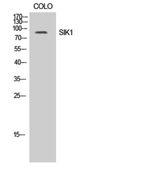 SIK1 antibody