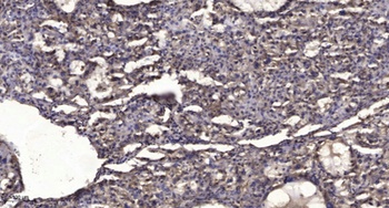 SIK1 rabbit pAb Antibody