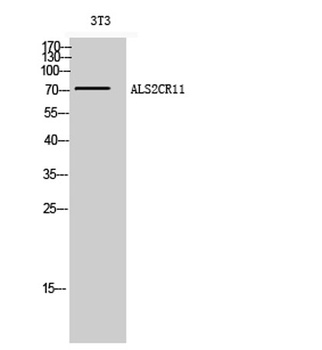 ALS2CR11 rabbit pAb Antibody
