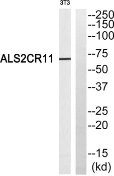 ALS2CR11 rabbit pAb Antibody