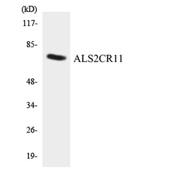 ALS2CR11 rabbit pAb Antibody