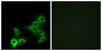 TGR5 antibody