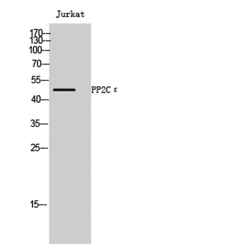 PP2Cε rabbit pAb Antibody