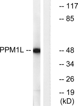 PP2Cε rabbit pAb Antibody