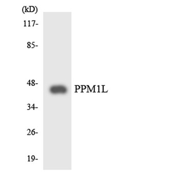 PP2Cε rabbit pAb Antibody