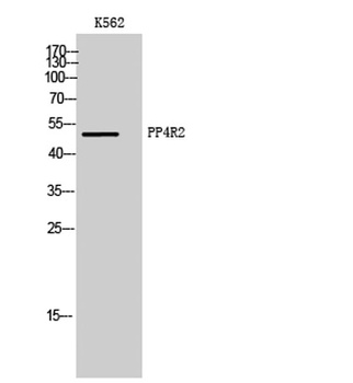 PP4R2 antibody