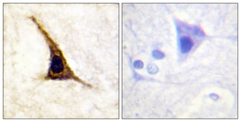 AR-β2 (phospho Ser355/S356) rabbit pAb
