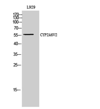 CYP2A6V2 antibody