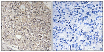 Angiomotin-L1 rabbit pAb
