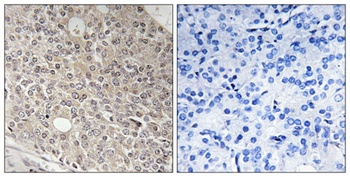 Angiomotin-L1 antibody