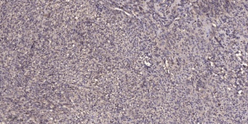 CYP2A6/7 rabbit pAb