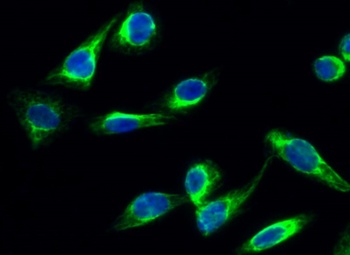 CYP17A1 rabbit pAb