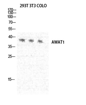 DGAT2L3 rabbit pAb Antibody