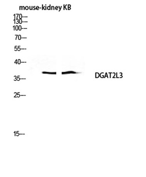 DGAT2L3 rabbit pAb Antibody