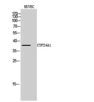 CYP24A1 antibody
