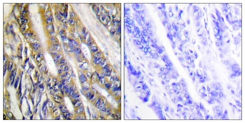 DGK-η rabbit pAb Antibody