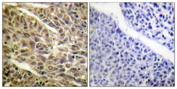 DAPK1 (phospho-Ser308) antibody