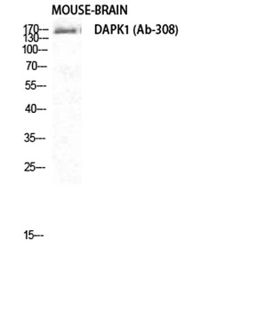 DAPK1 rabbit pAb