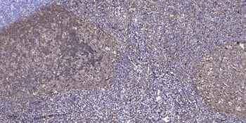 ZNF600 antibody