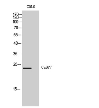 CaBP7 antibody