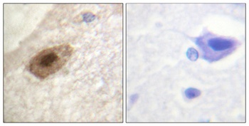 DDX3 (phospho Thr322) rabbit pAb