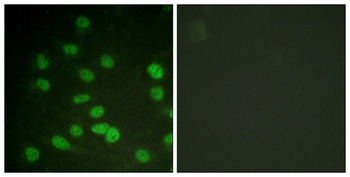 DDX3 (phospho Thr322) rabbit pAb Antibody