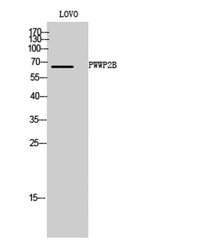 PWWP2B antibody