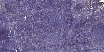 ADAMTS-17 rabbit pAb