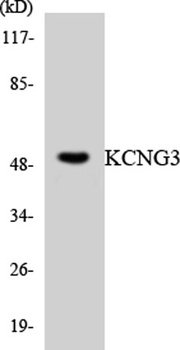 KCNG3 rabbit pAb Antibody