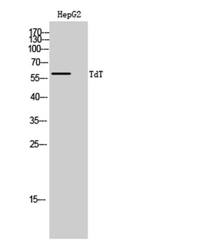 TdT antibody