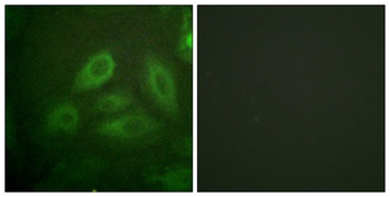 CRMP-2 (phospho Thr514) rabbit pAb Antibody