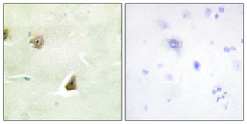 MKP-3 rabbit pAb Antibody
