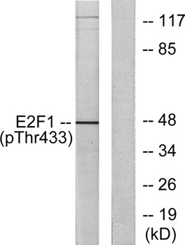 E2F-1 (phospho-Thr433) antibody