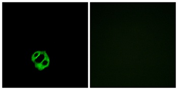 APLNR rabbit pAb Antibody