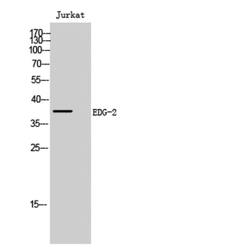 EDG-2 rabbit pAb Antibody