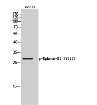 Ephrin-B1 (phospho-Tyr317) antibody